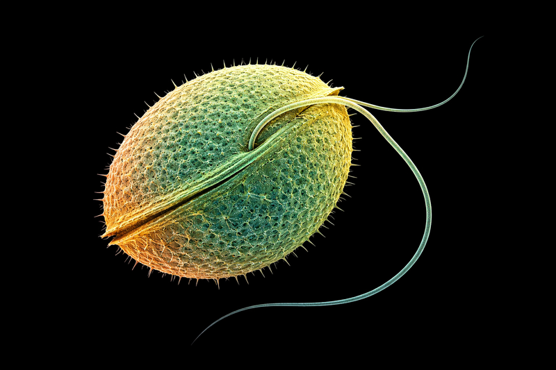 Toxic Algae